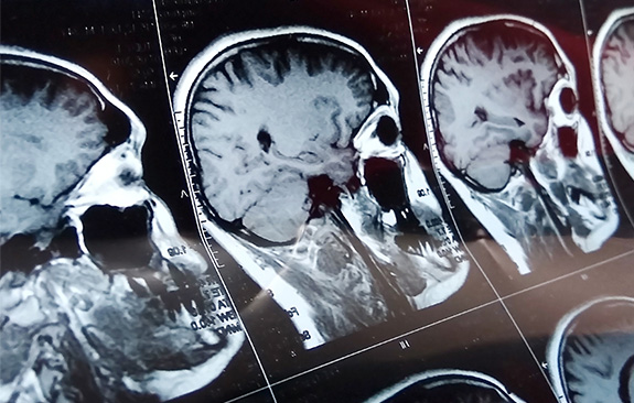 A psychologist with a veteran patient, a drawing of the brain, xrays of brains and two psychology students in the library